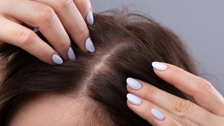 causes of hair loss MAIN